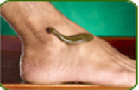 Ayurveda hospitals in kerala, Ayurveda in Kerala,Ayurveda treatments in kerala, Kerala mansoon, Punarnava Ayurveda Hospital Cochin, Kerala, India, resort, osteoarthritis, rheumatoid arthritis, low back ache, cervical spondylsis, psoriasis, allergic respiratory disorders , multiple sclerosis, age related mental stress, rheumatic diseases, health care, professional doctors, Pizhichil , Najavarakzhi, Sirodhara, Vasthi, Sirovasthi, Udvarthanam, Abhayangam,Rejuvenation Therapy, Body purification Therapy, Body Immunisation Programme, Slimming Programme, beauty care programme, Stress Management Programme.